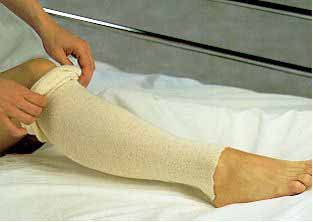Albahealth Stockinette Tubular 3 Inch X 25 Yard Cotton NonSterile (243650_CS) 12/CS